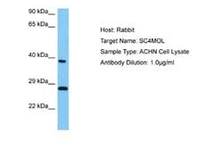 SC4MOL Rabbit anti-Human, Polyclonal, Novus Biologicals 0.1 mL | Buy Online | Novus Biologicals | Fisher Scientific
